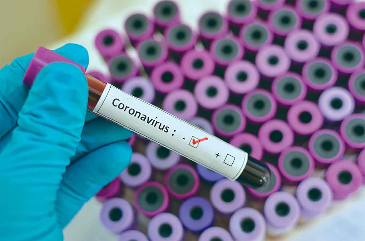 Santana de Parnaíba intensifica ações de combate ao Coronavírus